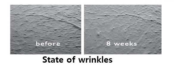 State of wrinkles