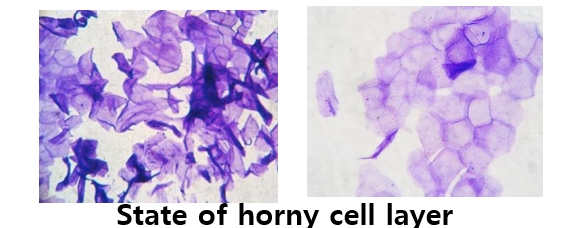 State of horny cell layer